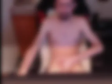 dermattes live webcam preview