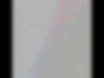 freckledfreaks photo 2