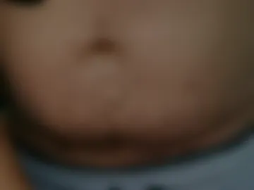 renesnap photo 2