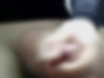 urethralpaly photo 3