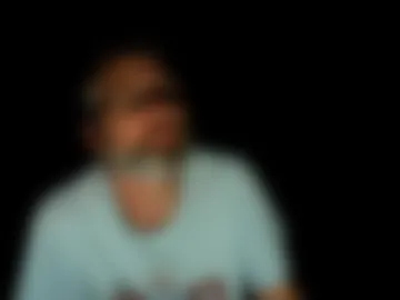 vitiligorick photo 5